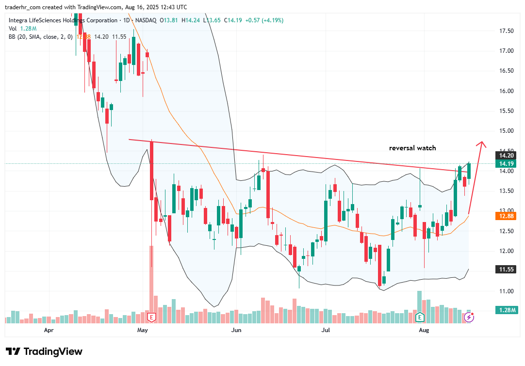 IART chart