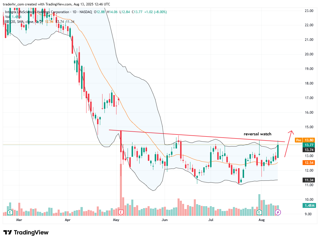IART chart
